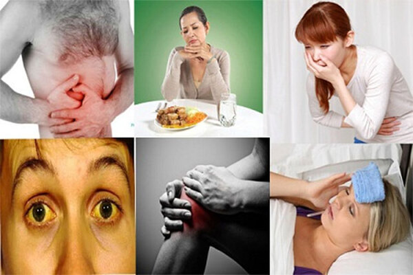 Các triệu chứng của viêm gan B